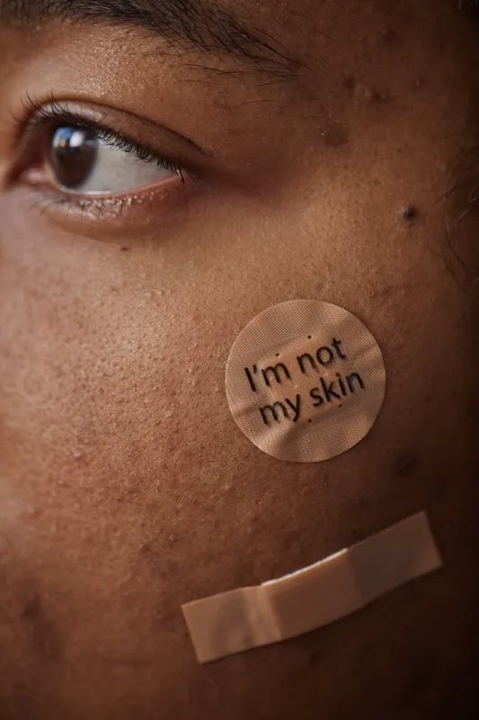 should i name my chapters