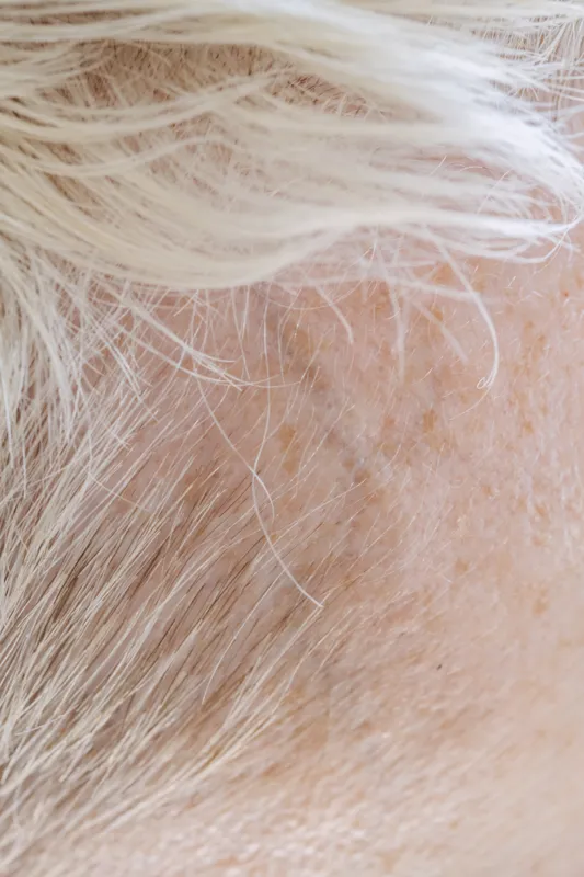 what is the basic structure of a short story